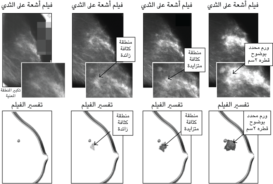 12 رقم مجموعة الصور
