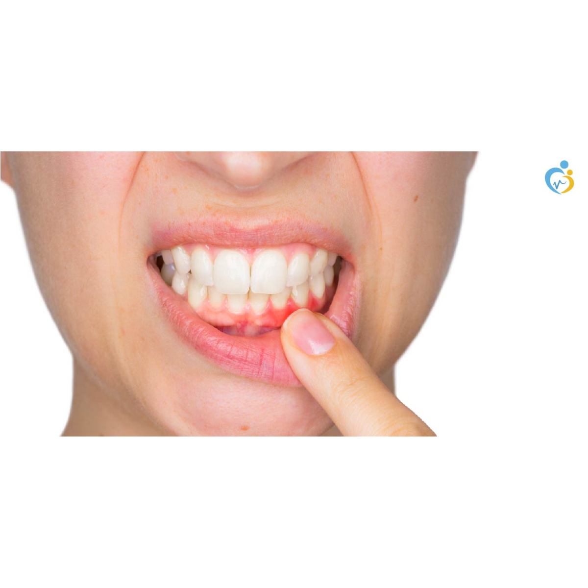 11 رقم مجموعة الصور