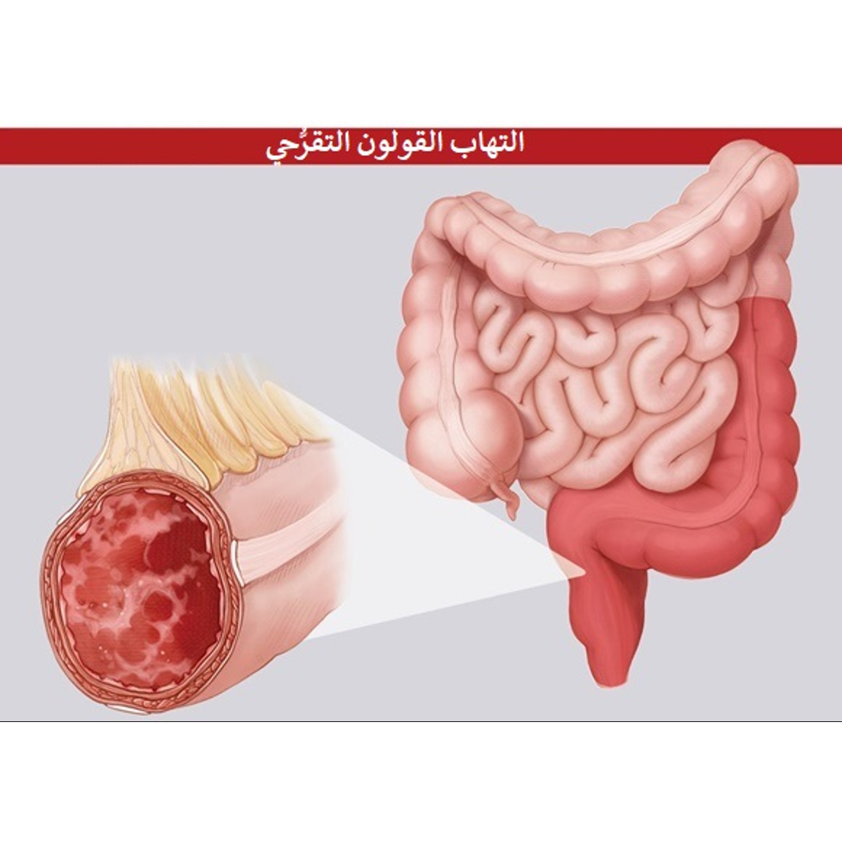 3 رقم مجموعة الصور