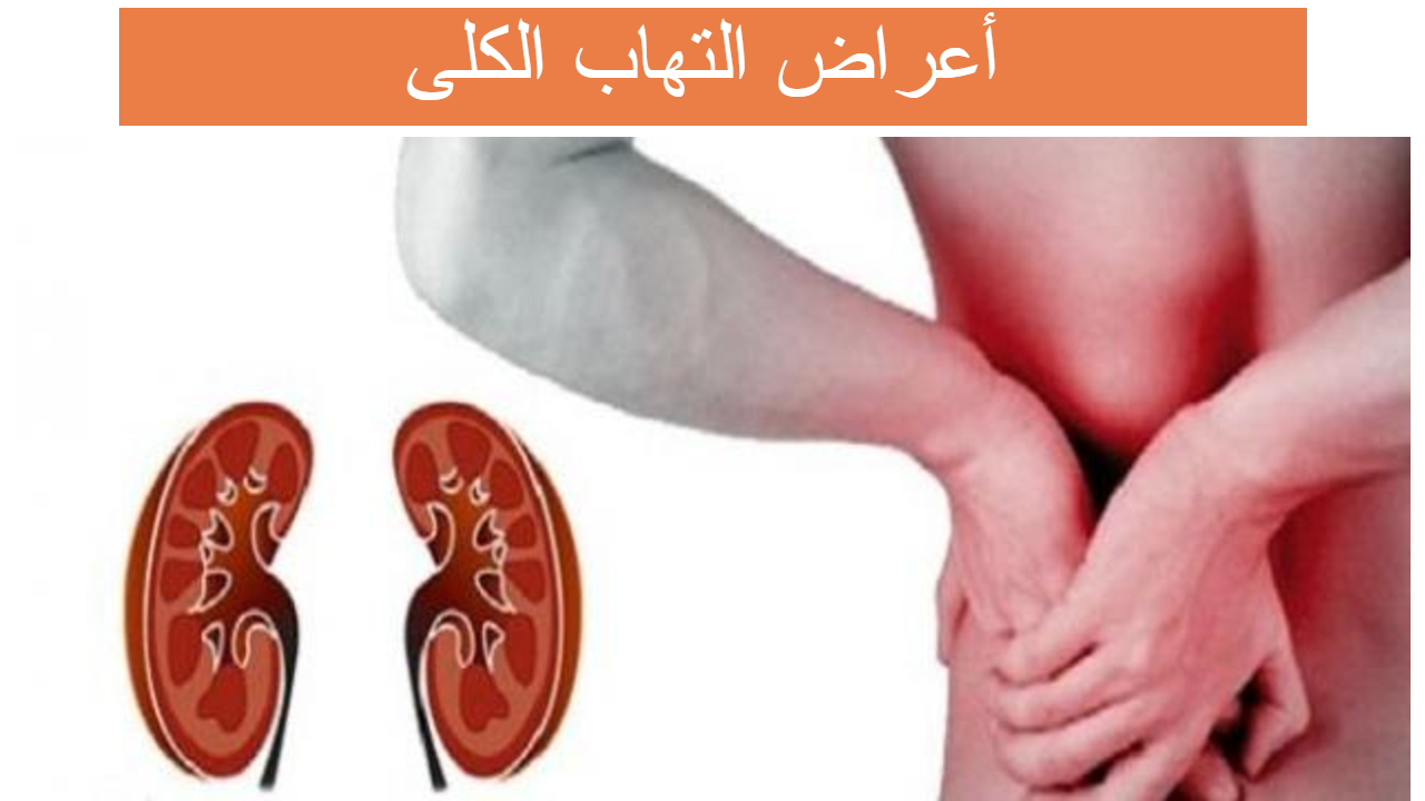 8 رقم مجموعة الصور