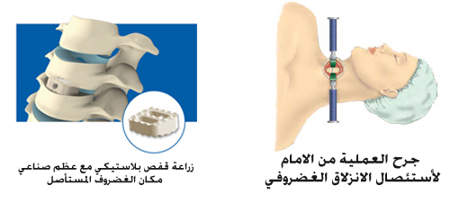 4 رقم مجموعة الصور