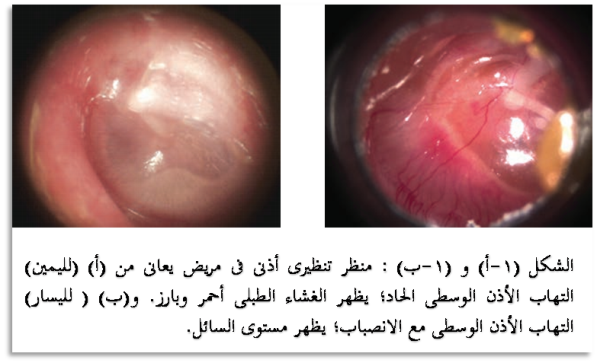 2 رقم مجموعة الصور