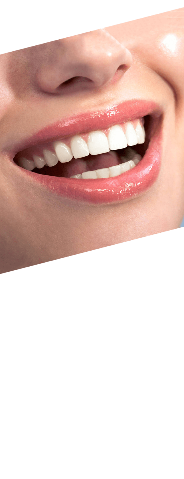12 رقم مجموعة الصور
