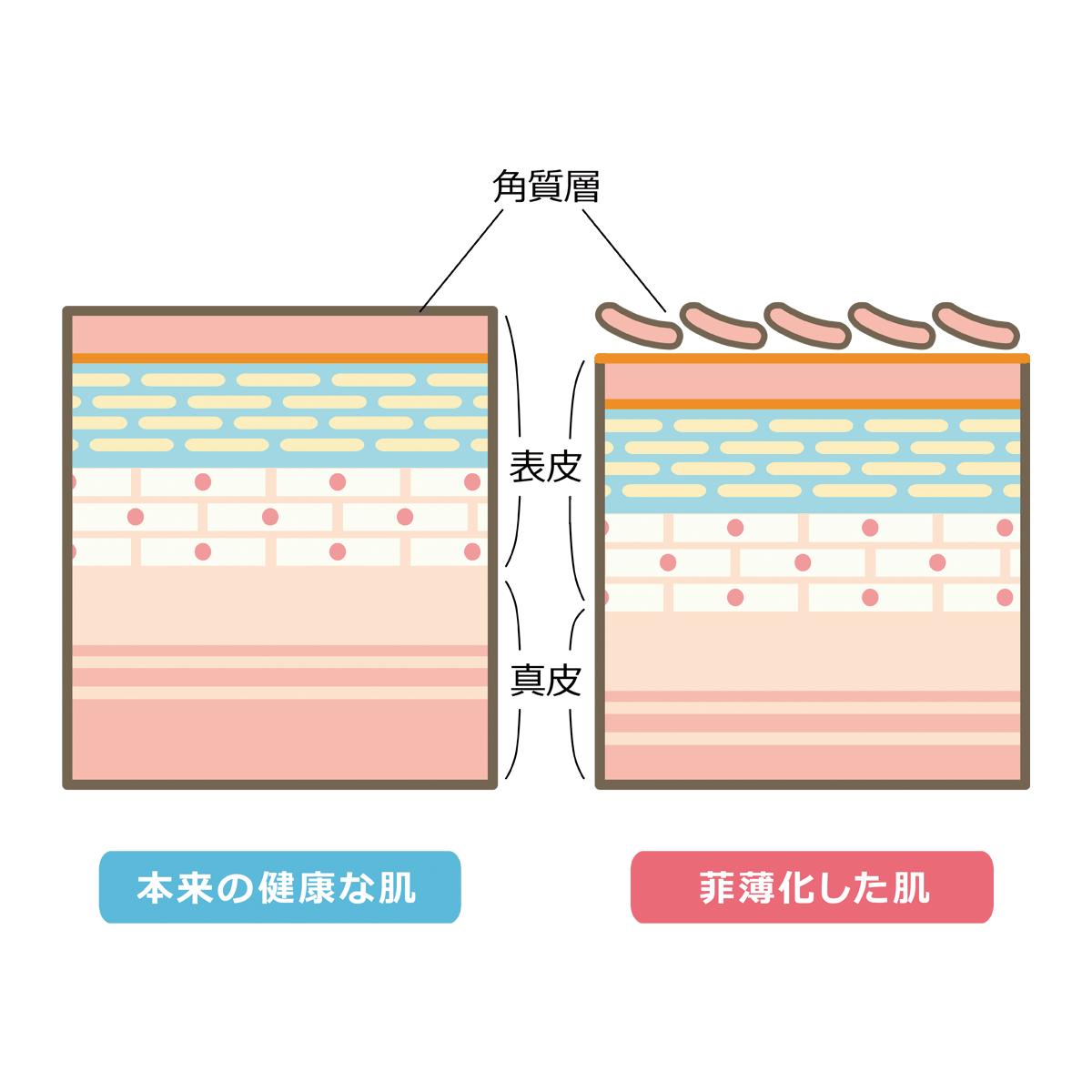 皮膚 構造 イラスト詳細 3位