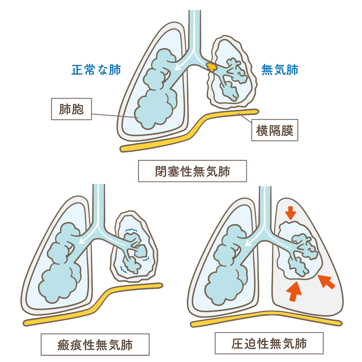 肺循環 イラスト詳細 8位