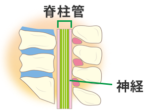 脊椎 イラスト詳細 9位