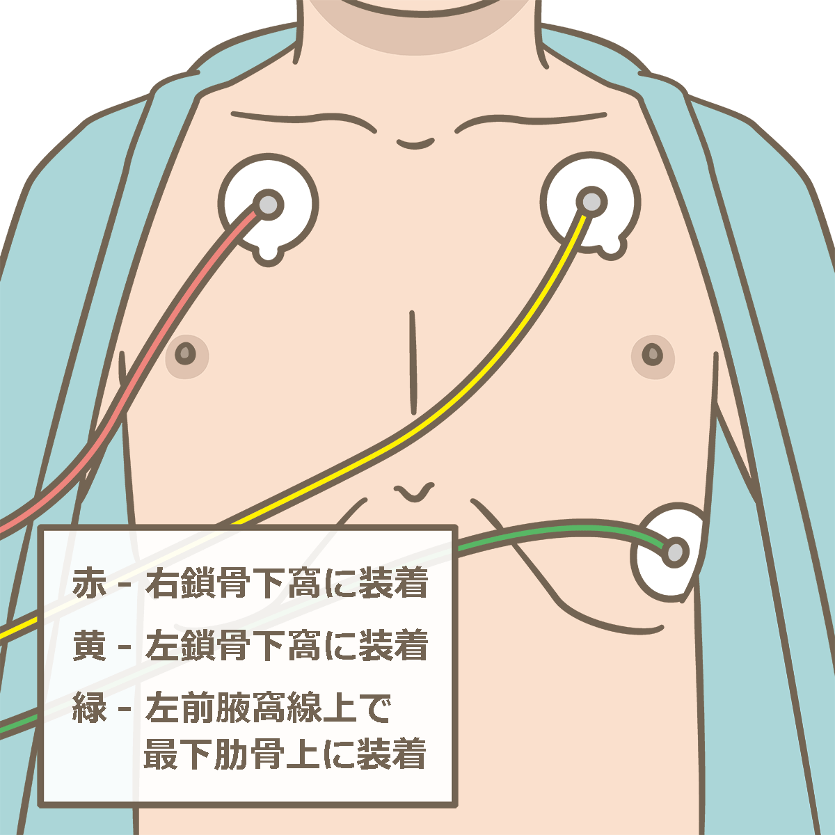 心電図 イラスト詳細 2位